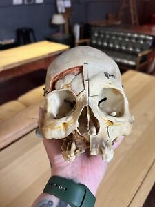 Clay Adams Skull Human Study Medical